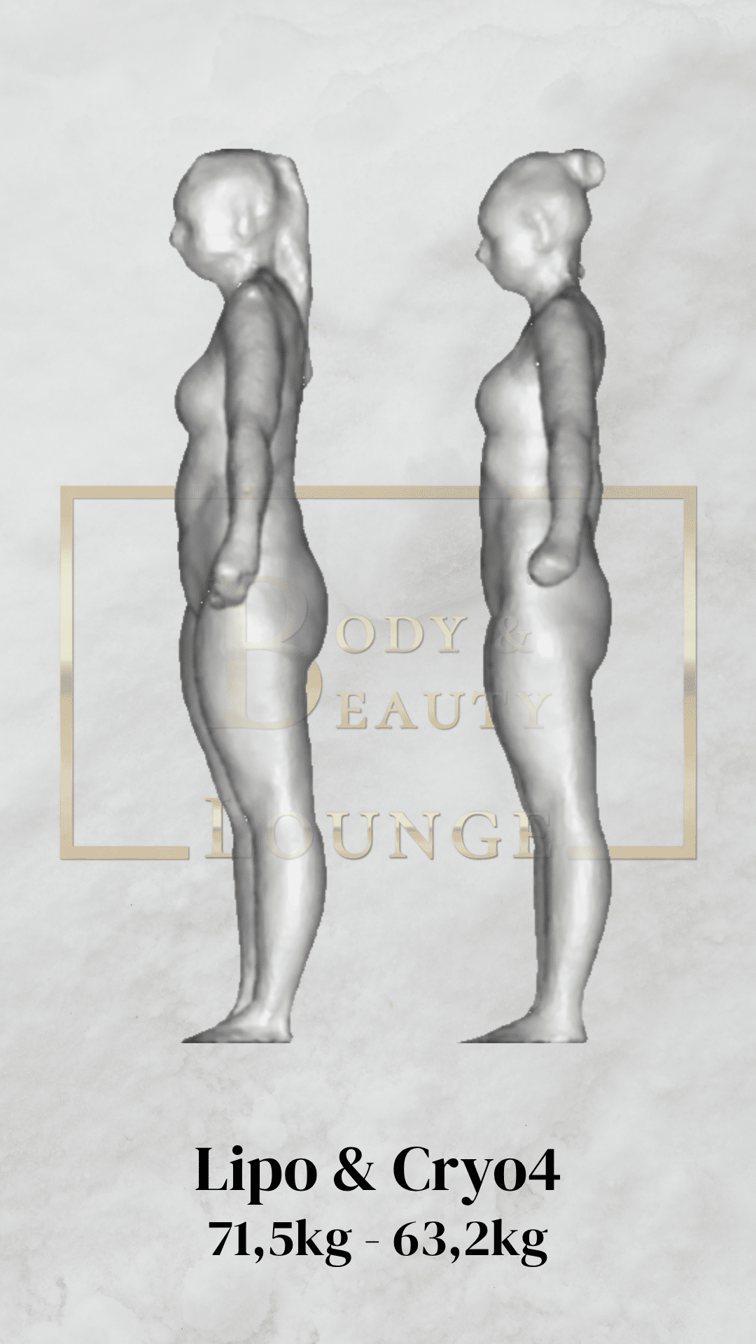 Resultaat EMS Reshape