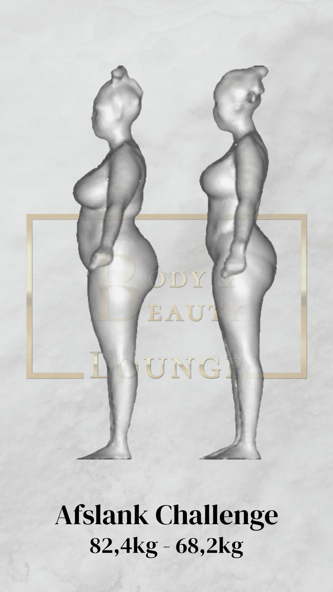 Resultaat Lipo & Cryo4