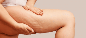 Been wordt gemasseerd net als tijdens de Bindweefselmassage in Hoogezand 