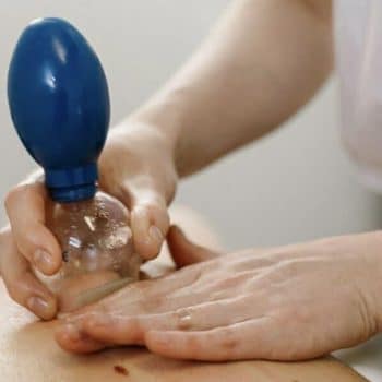 Transformational Cupping (Kuur)