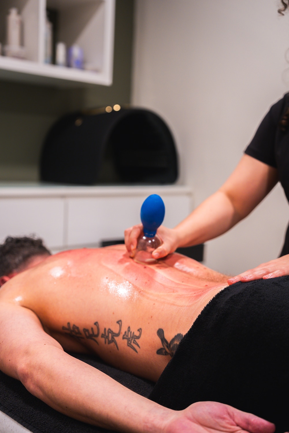 cupping